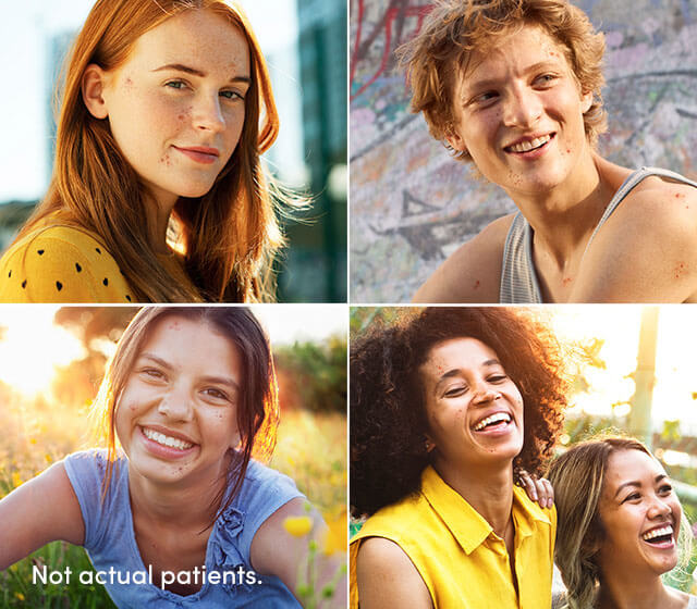 4 image collage of smiling patients with clearer skin represents AKLIEF® (trifarotene) Cream treating different skin types