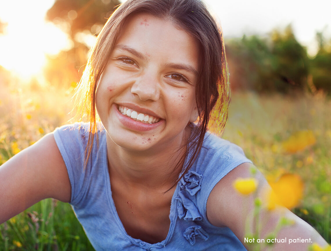 Pre-teen pediatric female smiling may benefit from AKLIEF® (trifarotene) Cream, indicated for patients 9 years or older