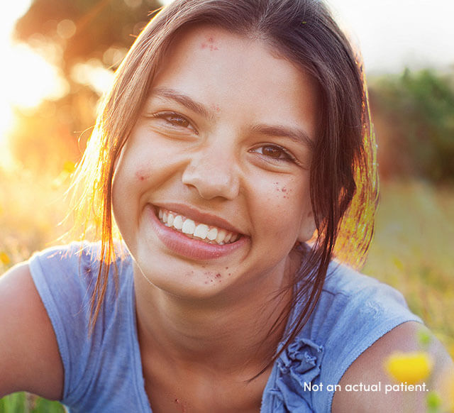 Pre-teen pediatric female smiling may benefit from AKLIEF® (trifarotene) Cream, indicated for patients 9 years or older