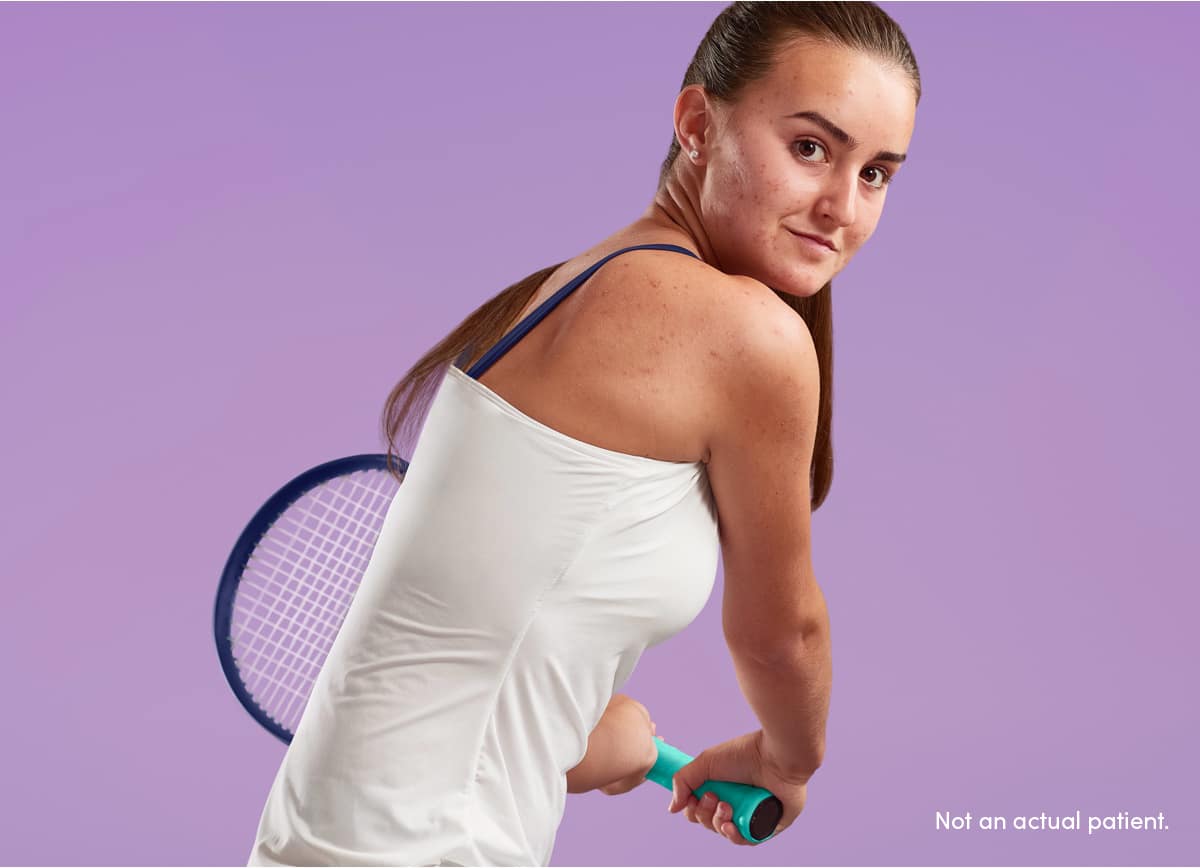 Teen girl ready to swing tennis racket reflects confidence from AKLIEF® Cream rapid results on her face, chest & back acne