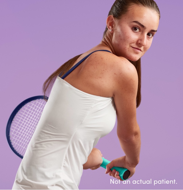 Teen girl ready to swing tennis racket reflects confidence from AKLIEF® Cream rapid results on her face, chest & back acne
