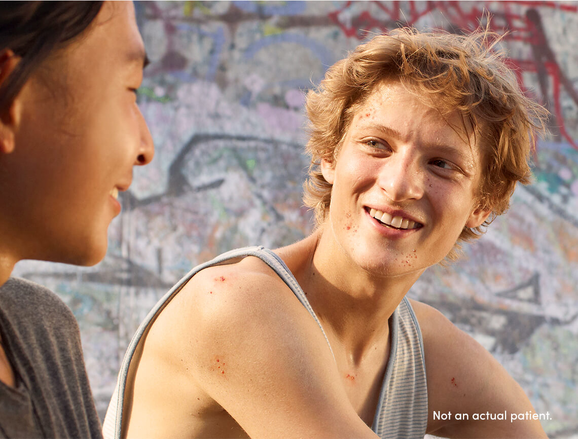 Teenagers may benefit from AKLIEF® (trifarotene) Cream. In clinical trials 47% of patients were teens 12-17 yrs old