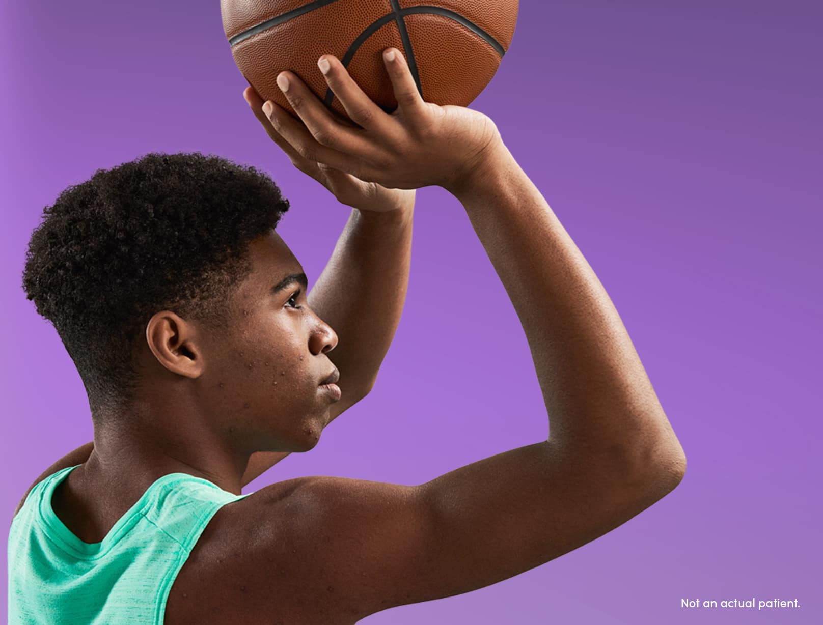 Teen boy ready to shoot basketball reflects confidence gained from using an acne treatment recommended by dermatologists