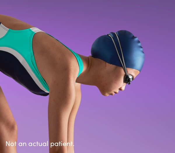 Female swimmer in start position portrays confident patient after treatment of acne vulgaris with AKLIEF® (trifarotene) Cream
