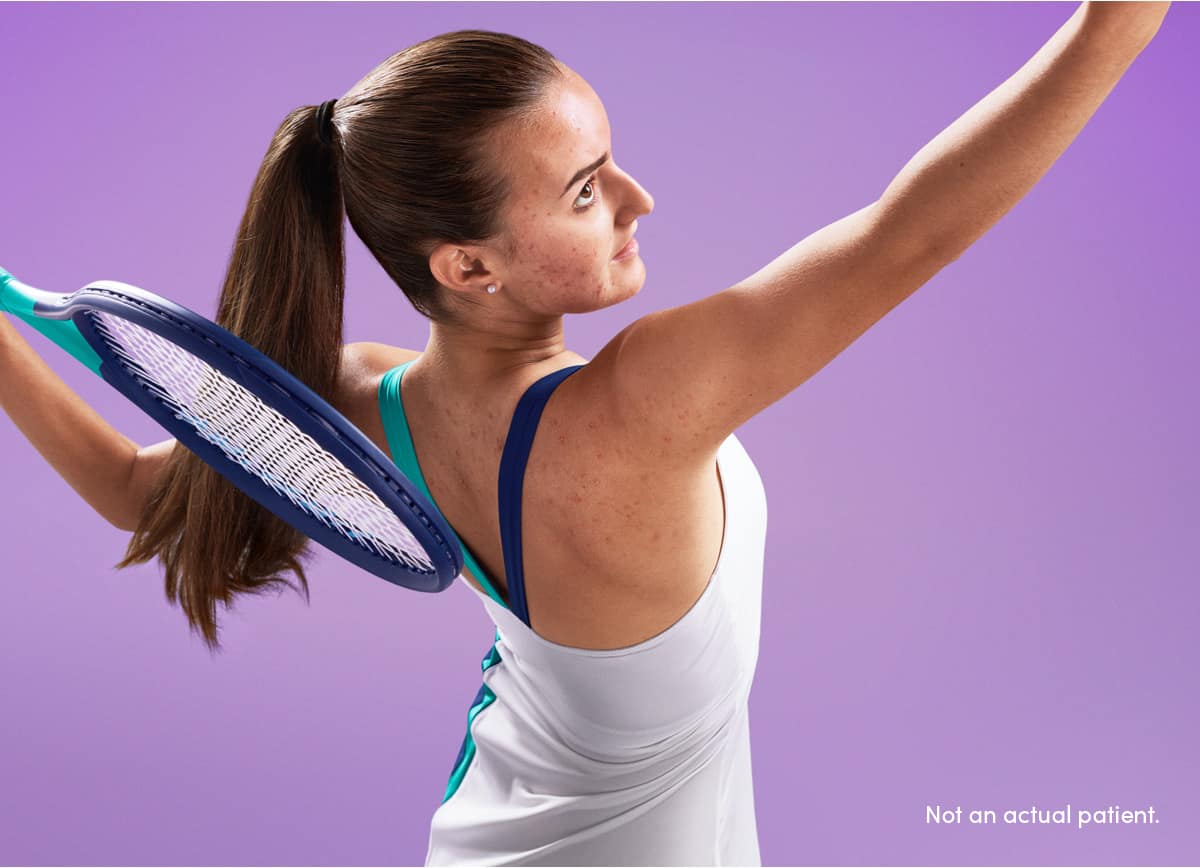 Teen girl serving tennis ball reflects a confident patient who can buy AKLIEF® Cream at a discount using patient savings card