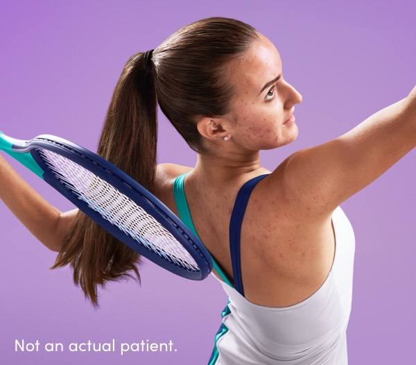 Teen girl serving tennis ball reflects a confident patient who can buy AKLIEF® Cream at a discount using patient savings card